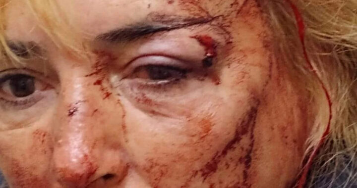 Una pareja denunció que recibió una brutal paliza en un bar de Villa Parque