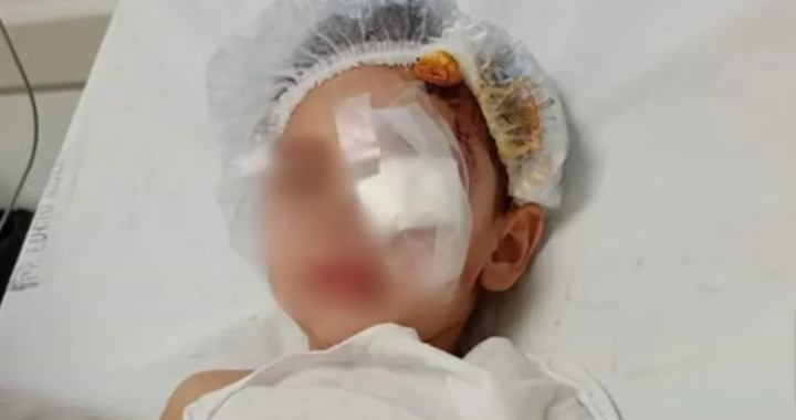 La Pampa: Un nene de 2 años fue atacado en la cara y la cabeza por un perro cruza con Gran Danés