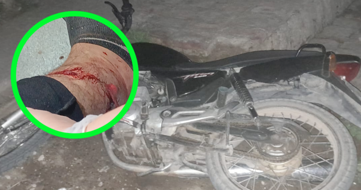 SANTA ROSA: IBA CAMINANDO JUNTO A SU PAREJA CUANDO DOS VARONES EN UNA MOTO COMENZARON A DISPARARLE EN EL PIE, PERO NO HIZO LA DENUNCIA; ¿AJUSTE DE CUENTAS?