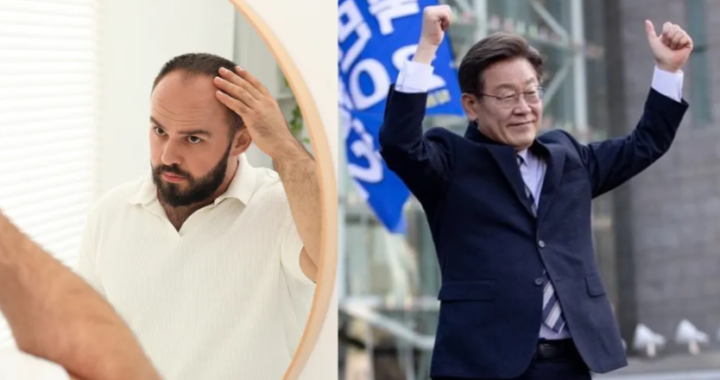 Estado presente: El presidente de Corea del Sur quiere que el implante de pelo sea gratuito